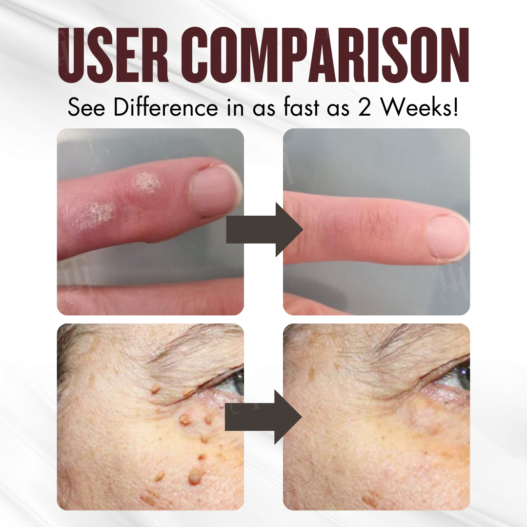 🌿 Painless Tag & Wart Removal | Brightens & Smooths in 14 Days | Cvreoz® All-in-1 Ceramide Skin Cream
