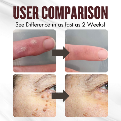 🌿 Painless Tag & Wart Removal | Brightens & Smooths in 14 Days | Cvreoz® All-in-1 Ceramide Skin Cream