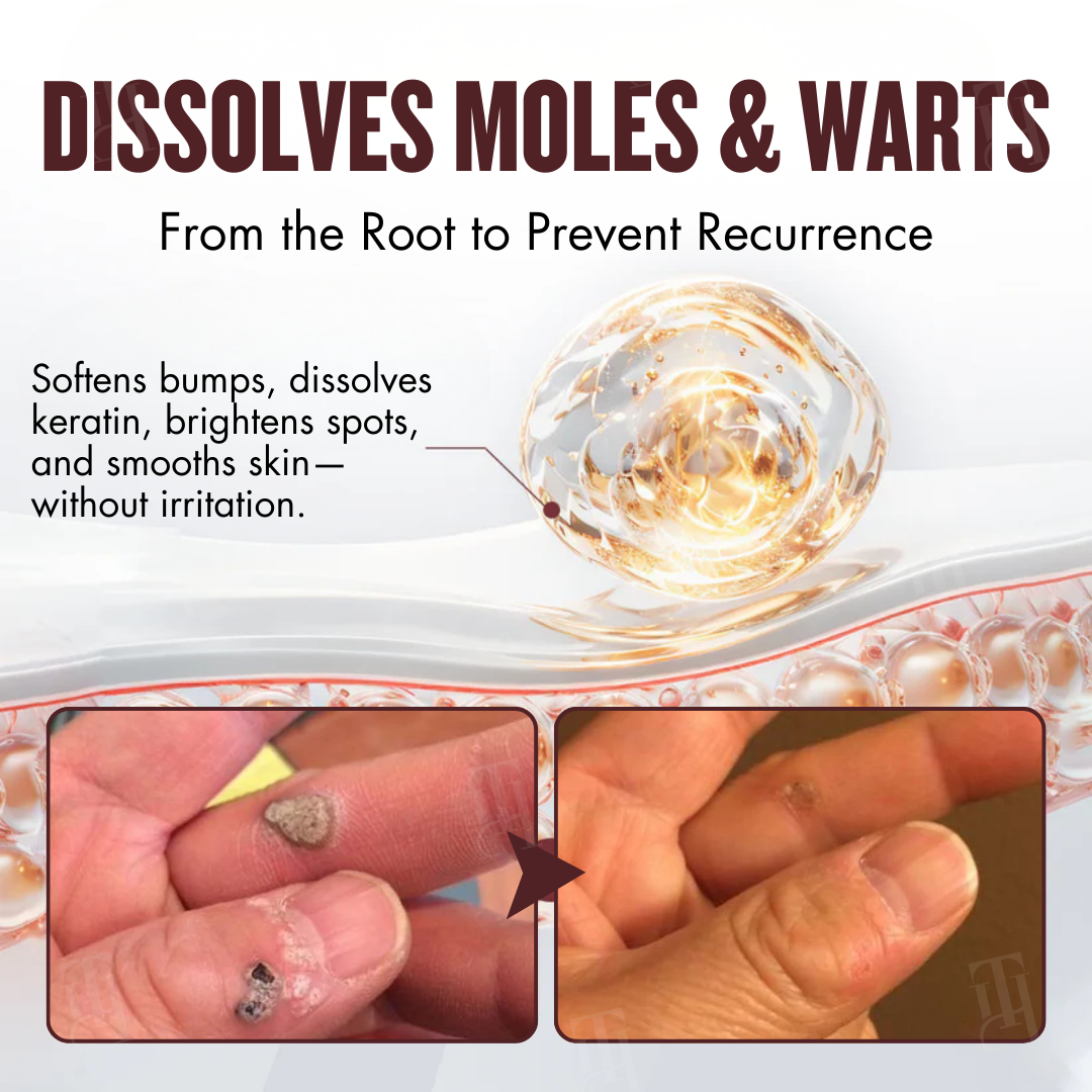 🌿 Painless Tag & Wart Removal | Brightens & Smooths in 14 Days | Cvreoz® All-in-1 Ceramide Skin Cream