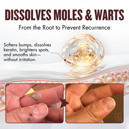 🌿 Painless Tag & Wart Removal | Brightens & Smooths in 14 Days | Cvreoz® All-in-1 Ceramide Skin Cream