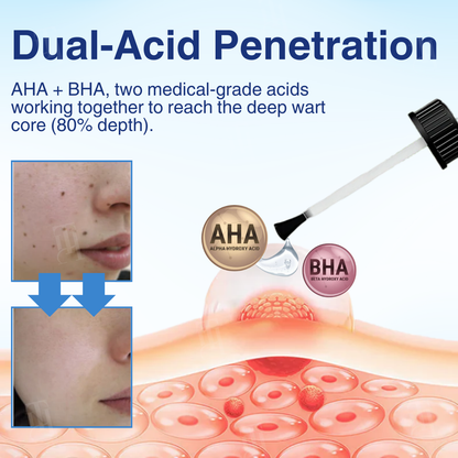 🏆 Official Store | Cvreoz® AHA Wart Removal Liquid