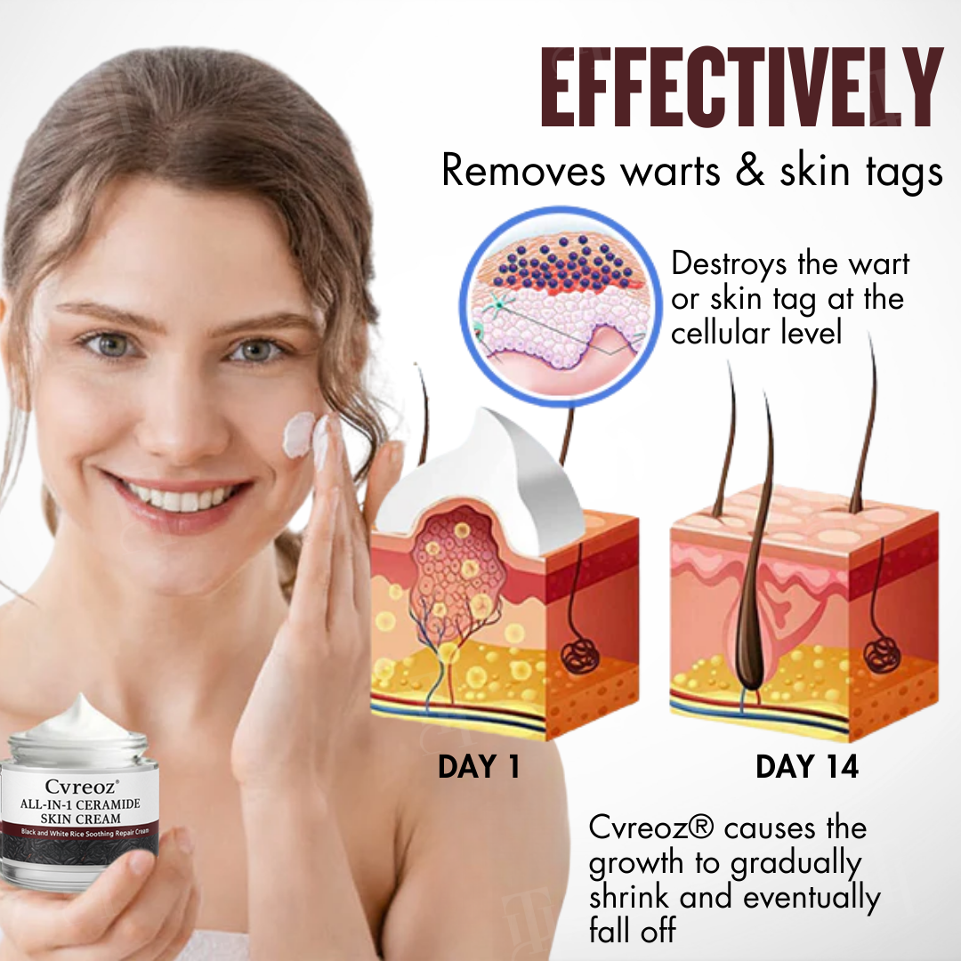 🌿 Painless Tag & Wart Removal | Brightens & Smooths in 14 Days | Cvreoz® All-in-1 Ceramide Skin Cream