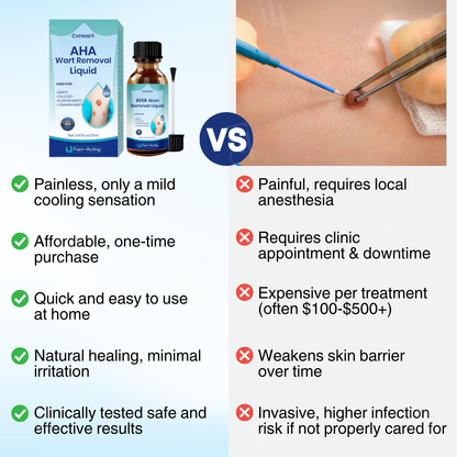 🏆 Official Store | Cvreoz® AHA Wart Removal Liquid