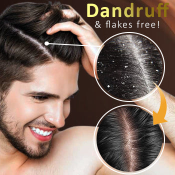 AEXZR® Anti-Dandruff Treatment Essence
