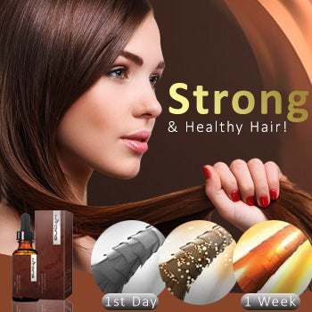 AEXZR® Anti-Dandruff Treatment Essence