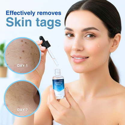 🧬 Pain-Free & Scarless in 14 Days | Cvreoz® Advanced Skin Tag & Wart Removal Essence