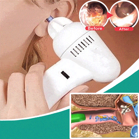 HEATWOLF® Ear Wax Easy Remover